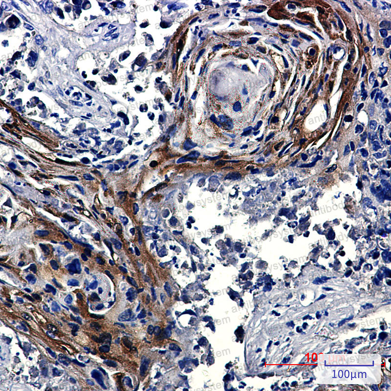 Валидация AntibodySystem RHD06504