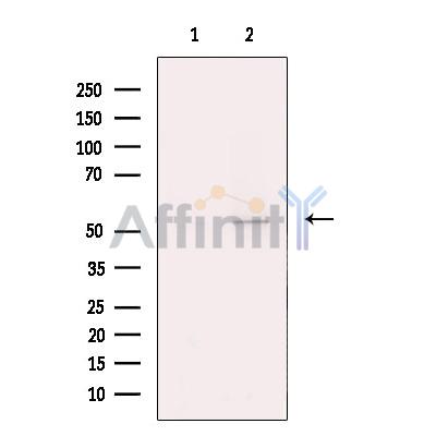 Валидация Affinity DF13222 - 8248