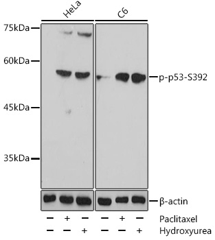 AP0860, вестерн-блоттинг, лизаты клеток HeLa и C6 (27869)