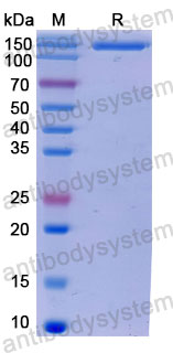 Валидация SDS-PAGE - AntibodySystem DHE19101