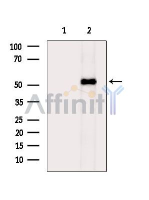 Валидация Affinity DF13946 - 9693
