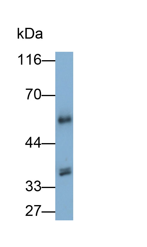 14714