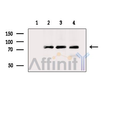 Валидация Affinity DF14215 - 10053