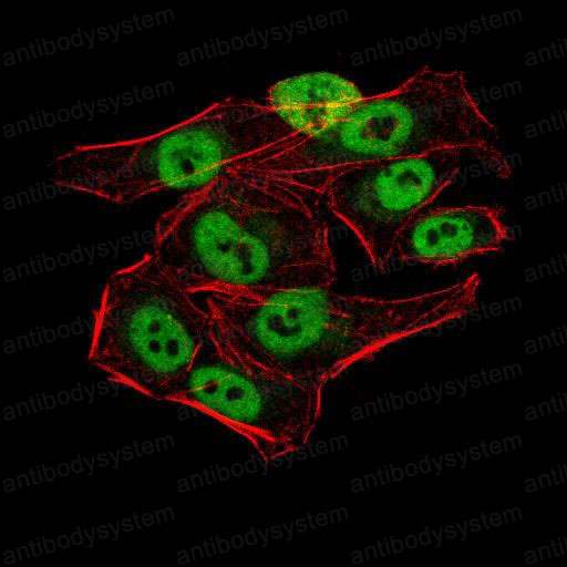 Валидация IF - AntibodySystem RHN94701
