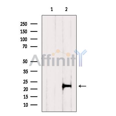 Валидация Affinity DF6016 - 17235