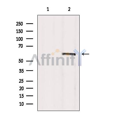 Валидация Affinity AF6260 - 3510