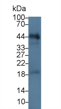 13993