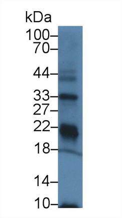 14884