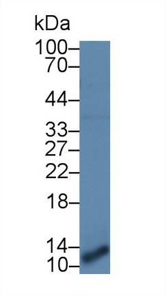 12335
