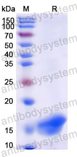 Валидация SDS-PAGE - AntibodySystem RXX08601
