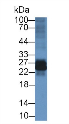 9141