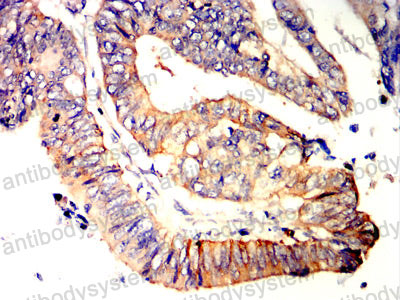 Валидация AntibodySystem RHJ02207