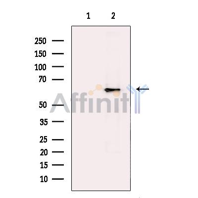 Валидация Affinity DF13285 - 8403