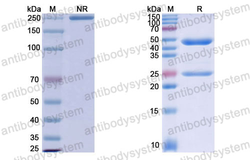 Валидация SDS-PAGE - AntibodySystem FGJ92910