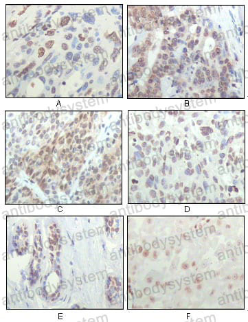 Валидация AntibodySystem RHH09504 (3174)