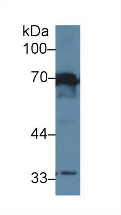 12374