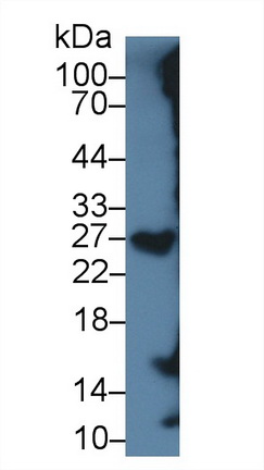 14879