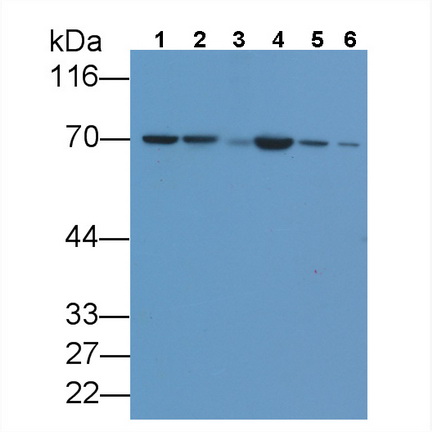 14681