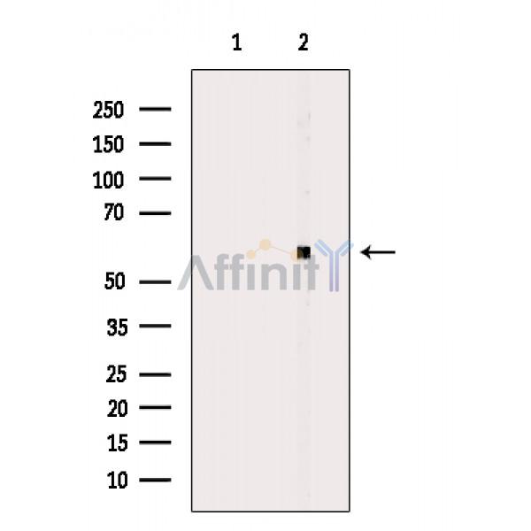 Валидация Affinity DF3583 - 14539