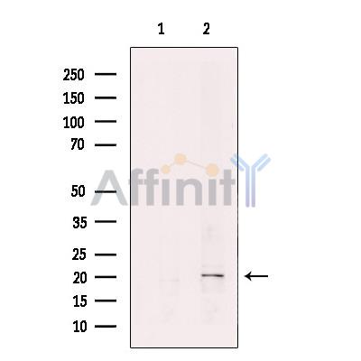 Валидация Affinity DF12464 - 7010
