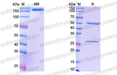 Валидация SDS-PAGE - AntibodySystem FMK18310