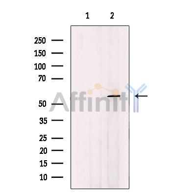 Валидация Affinity DF12363 - 6808