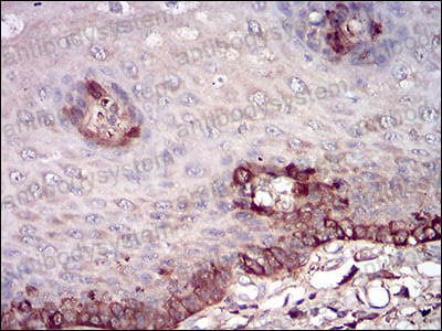 Валидация AntibodySystem RHC02402