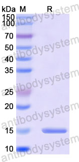 Валидация SDS-PAGE - AntibodySystem RVV30701