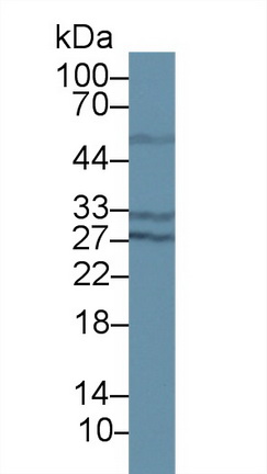 14424