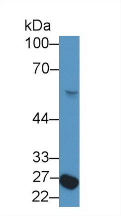 9285