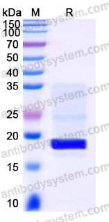 EHJ42901, SDS-PAGE