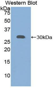 52141
