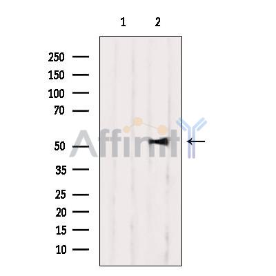 Валидация Affinity AF5119 - 2484