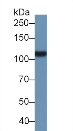10035