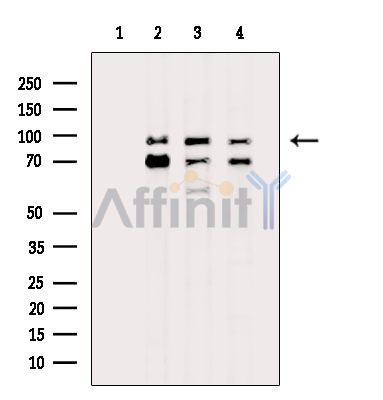 Валидация Affinity DF14943 - 11126
