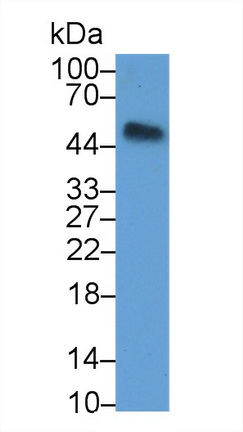 38935