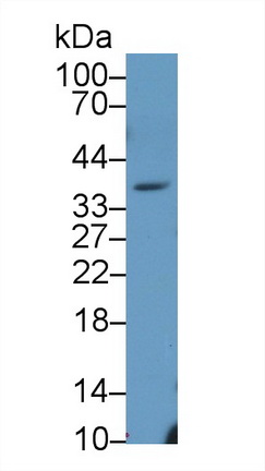 12340