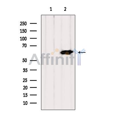 Валидация Affinity DF9397 - 21938