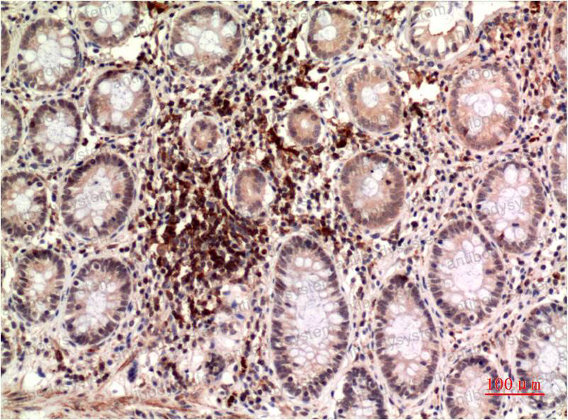 Валидация AntibodySystem RHN94103 (3975)
