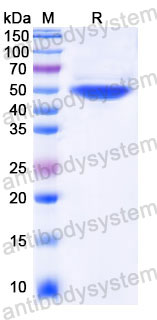 EHC34601, SDS-PAGE