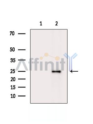 Валидация Affinity DF14446 - 10413