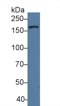 14276