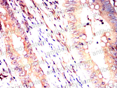 Валидация AntibodySystem RHC06301