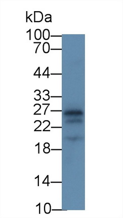 14856