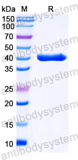 Валидация SDS-PAGE - AntibodySystem FWK30520