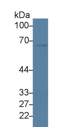 14241