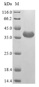 SDS-PAGE