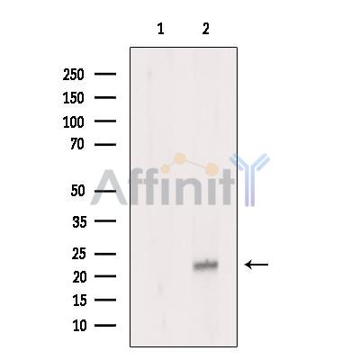 Валидация Affinity DF8876 - 20979