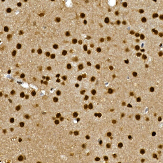 A15613, иммуногистохимия, парафиновые срезы мозга крысы (11992)