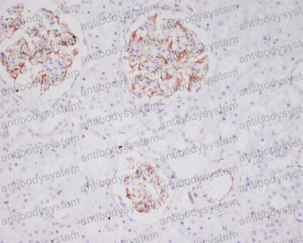 Валидация AntibodySystem RHD38101